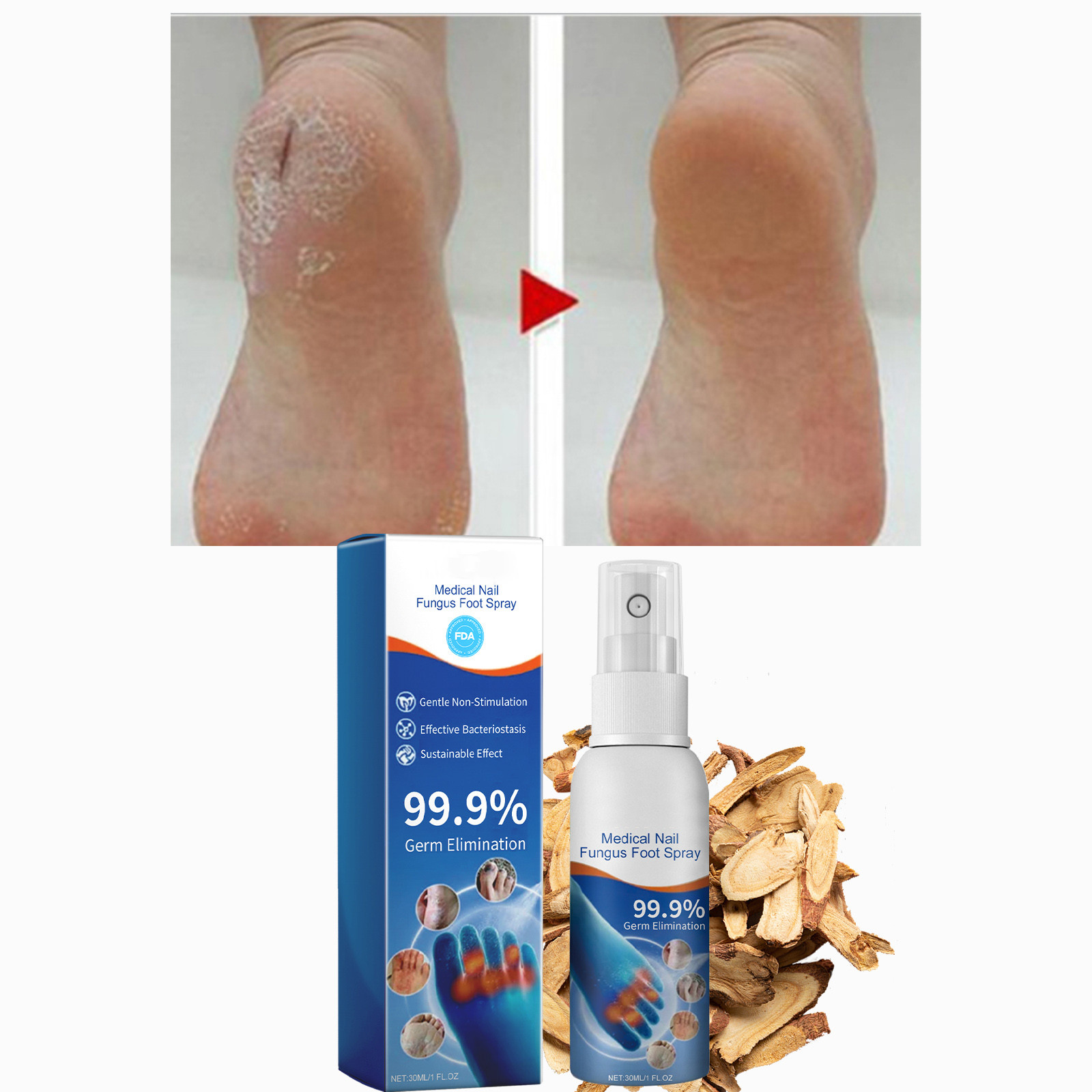 Foot Spray Antifungal 30ml Herbal Foot Spray, Foot Sweat, Foot Odor, Itching Relieving Spray, Odor Peeling Foot Care Spray